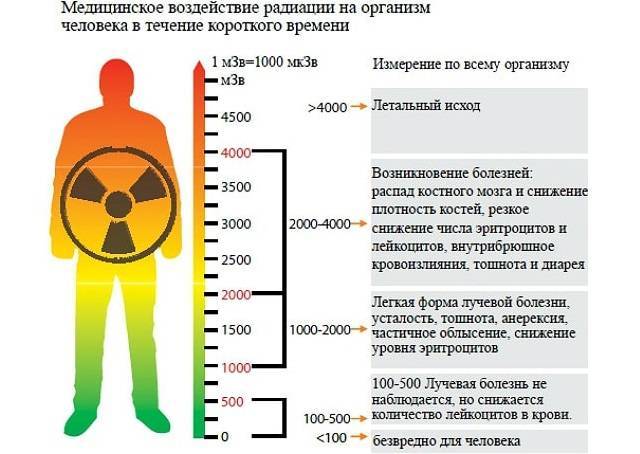 Рентгена 5 карта